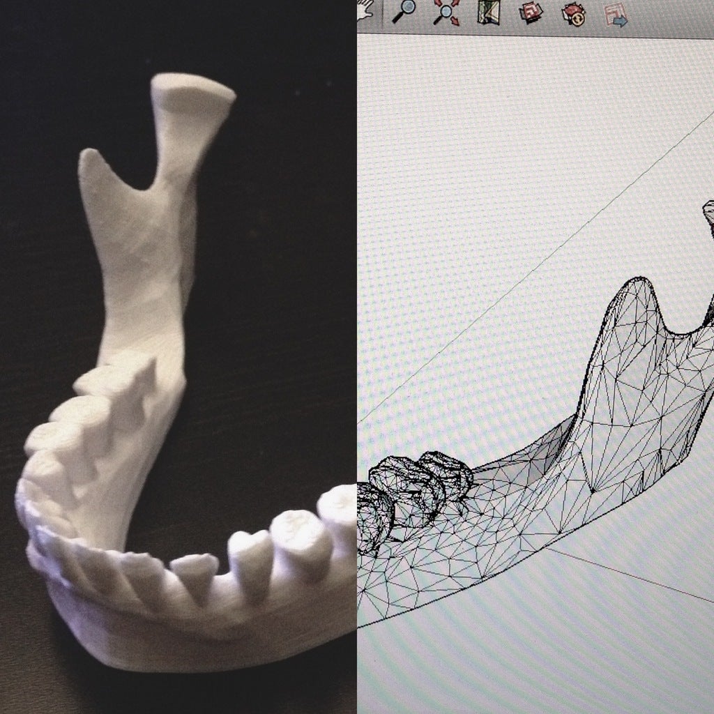 Jaw iPad-Ständer: Menschliches Kiefermodell und iPad-Halter